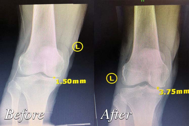 photo of Before and after treatment by Granite Bay Medical Center