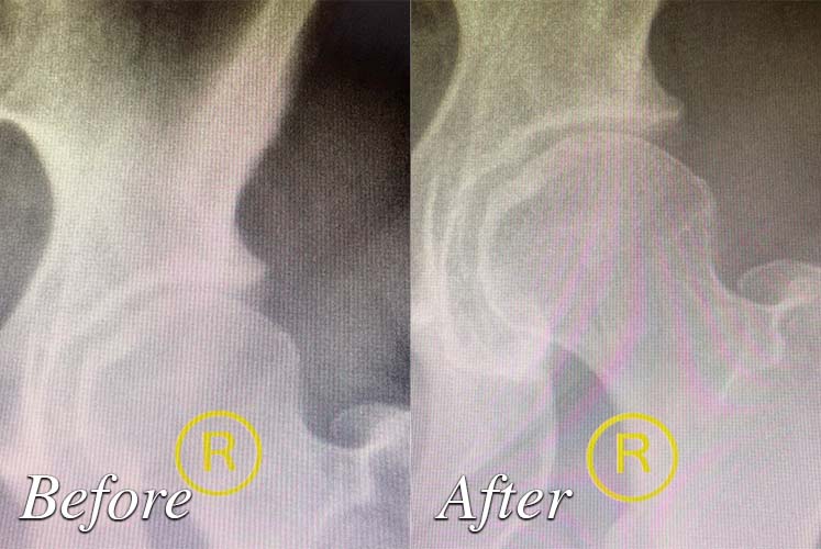 Photo of Before and after treatment by Granite Bay Medical Center