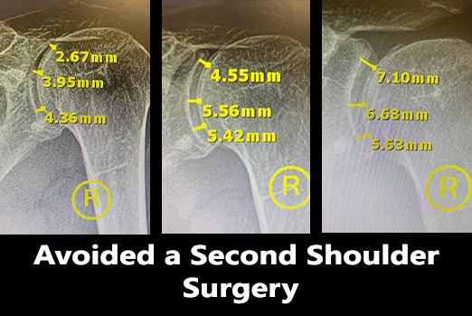 Chiropractor Dr. Neil K Hersh, M.D.